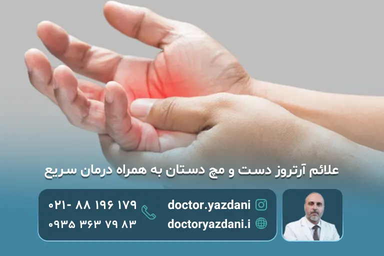 آرتروز انگشتان دست